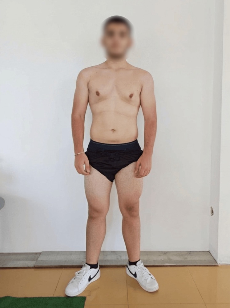 Antes - transformação de um cliente do Balance